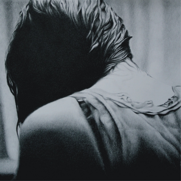Scars